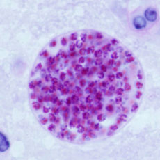 Antihematozoario